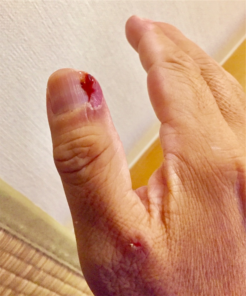 f:id:acsekitori:20190911164838j:image