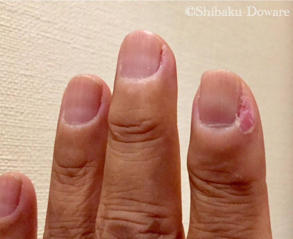 f:id:acsekitori:20190911193111j:image