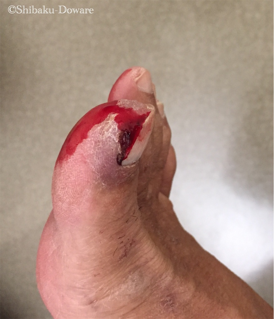 f:id:acsekitori:20191129151802j:image