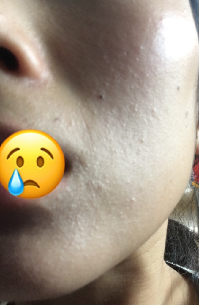 f:id:acupuncture_728199:20170919142346j:plain