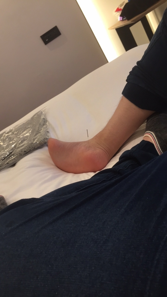 f:id:acupuncturist_ryo:20180509000149j:plain