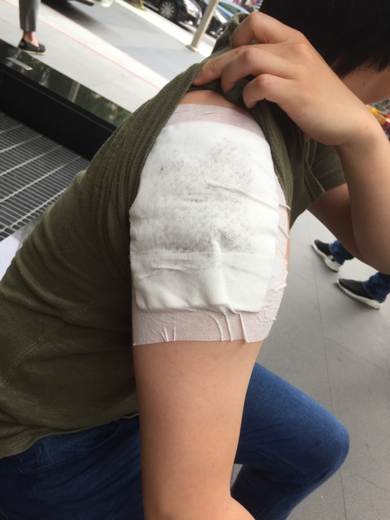 f:id:acupuncturist_ryo:20180509154934j:plain