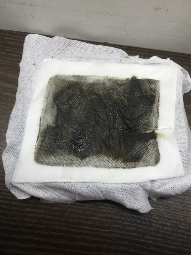 f:id:acupuncturist_ryo:20180509154943j:plain