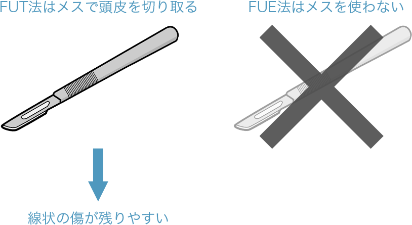 f:id:aga-aga:20170205084951p:plain f:id:aga-aga:20170205084951p:plain
