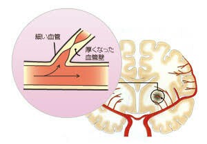 f:id:aiko-and-sibajyun:20170112142339j:image f:id:aiko-and-sibajyun:20170112142339j:image