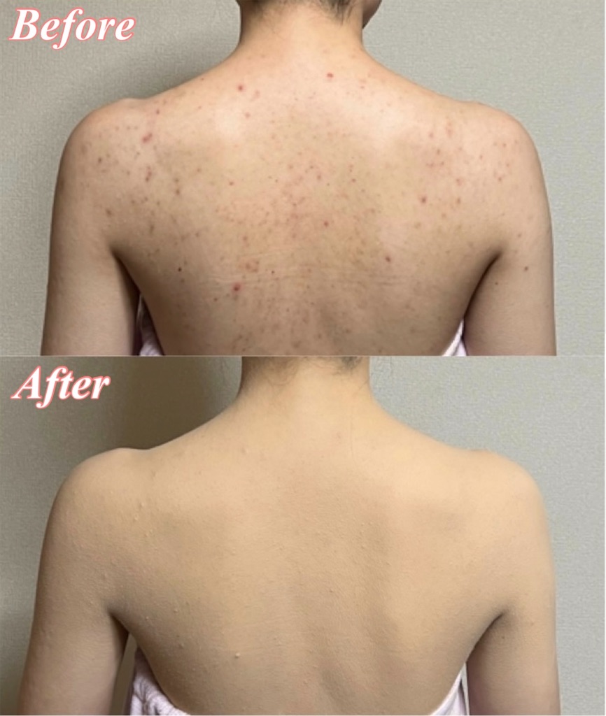 f:id:airbrushartkiyo:20230302010624j:image