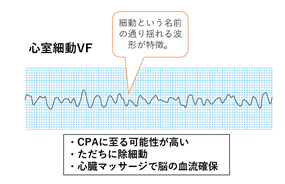 f:id:aisonashiyakuzaishi:20210304055128p:plain