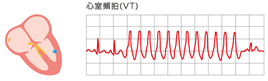 f:id:aisonashiyakuzaishi:20210304055150p:plain