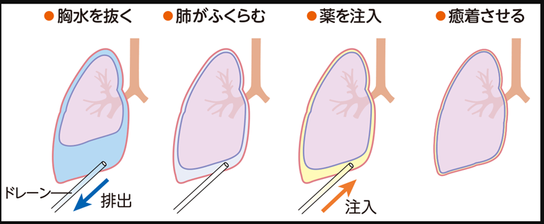 f:id:aisonashiyakuzaishi:20211215075713p:plain