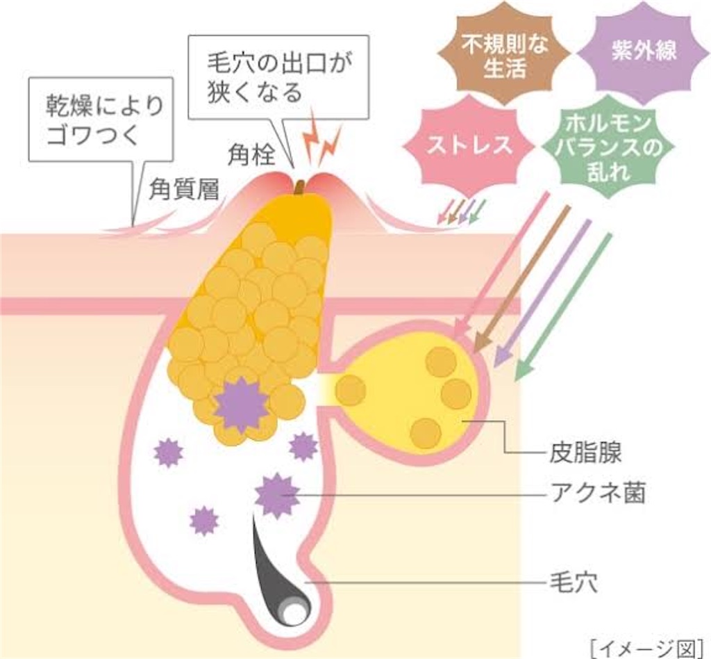 f:id:akachanhada:20211203192856j:image