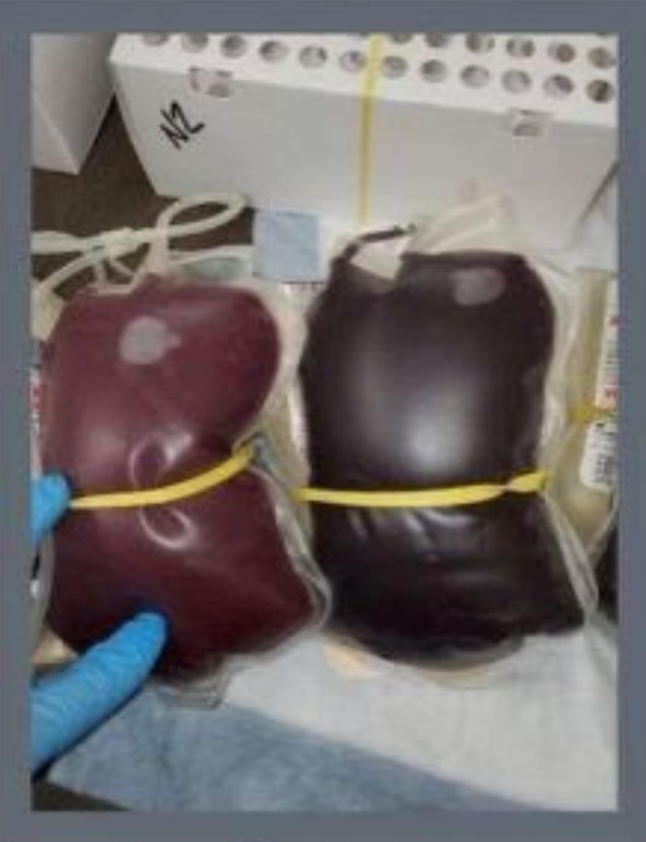 f:id:akahanama1:20210919105203j:plain