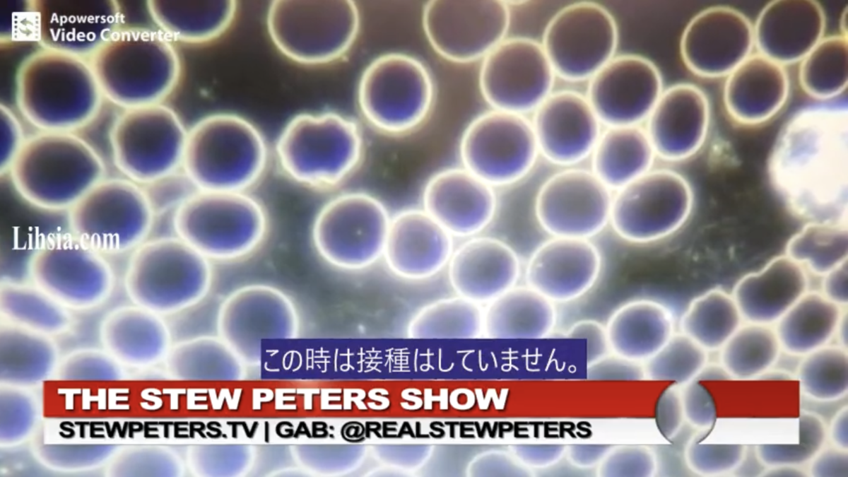 ワクチン接種前の赤血球