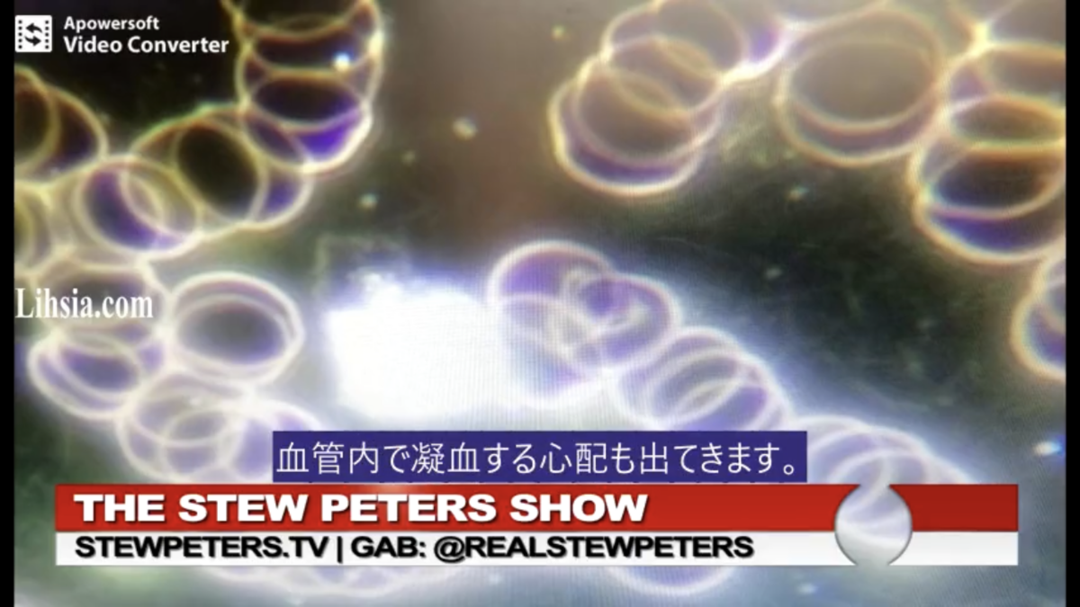 ワクチン接種後の赤血球