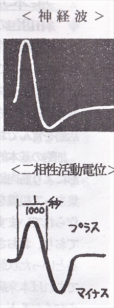 神経波の波形