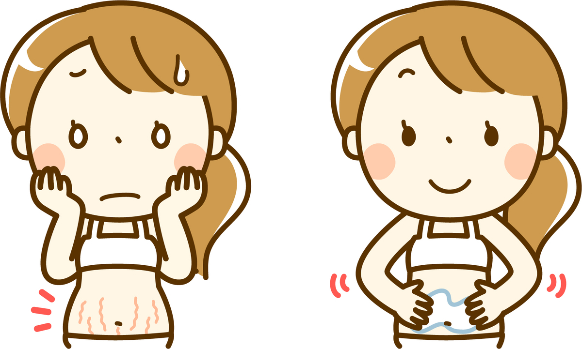f:id:akanenechan:20190816162245j:plain f:id:akanenechan:20190816162245j:plain