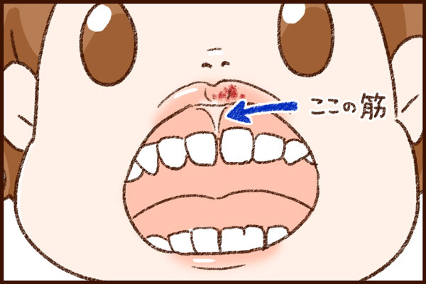 f:id:akasuguedi:20170124005853j:plain