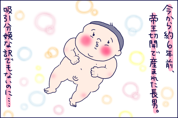 うちゅうじん 生まれたての息子の頭がとんがってる 向き癖も加わって頭の形が By うえだしろこ ゼクシィbaby 妊娠 出産 育児 みんなの体験記
