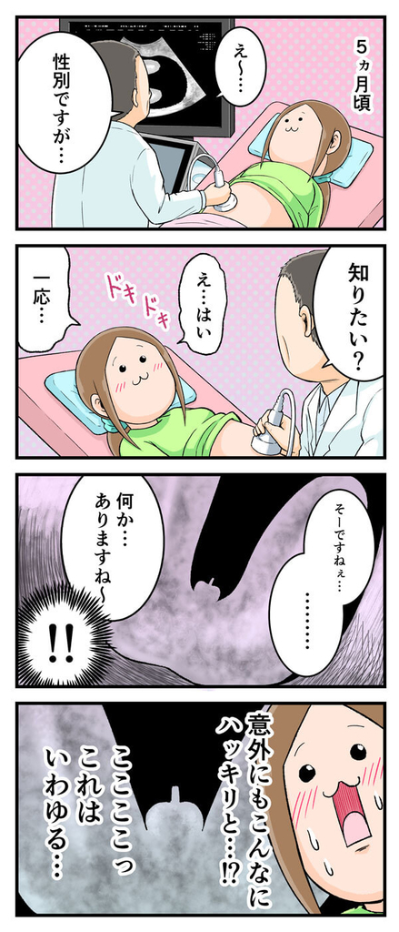 んっふっふっふ 映し出される度に笑いに包まれた あのエコー画像 By にくきゅうぷにお ゼクシィbaby 妊娠 出産 育児 みんなの体験記