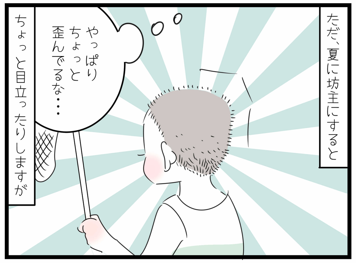 いつかは治るかもしれないけど 今できることは 娘の 向き癖防止 にドーナツ枕を買ってみたけど Byぺぷり ゼクシィbaby 妊娠 出産 育児 みんなの体験記 いつかは治るかもしれないけど 今できることは 娘の 向き癖防止 にドーナツ枕を買ってみたけど Byぺぷり ゼクシィbaby 妊娠 出産 育児 みんなの体験記