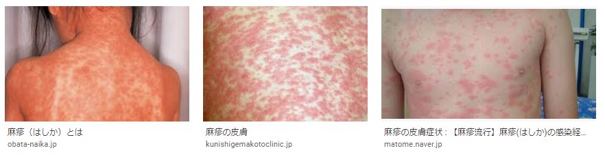 f:id:akihitosuzuki:20200519081930j:plain f:id:akihitosuzuki:20200519081930j:plain