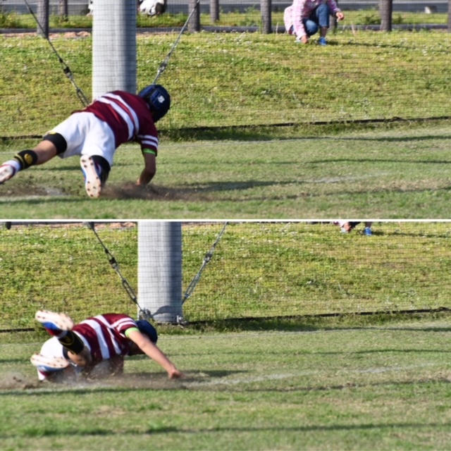 ジャンパー膝 ランナー膝