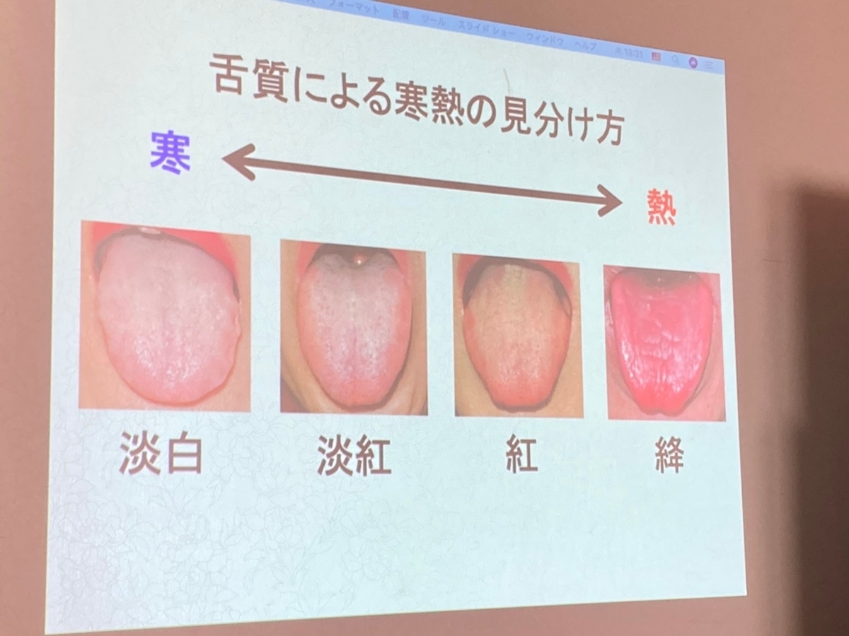 舌診 - 千葉の鍼灸便り
