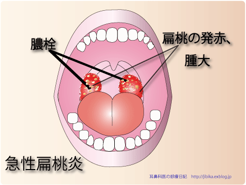 f:id:akita319:20130604060818g:image