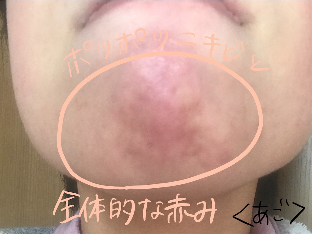 f:id:akkimemo:20190108142111j:image