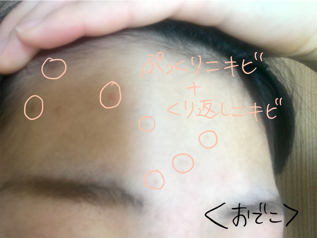 f:id:akkimemo:20190108142116j:image