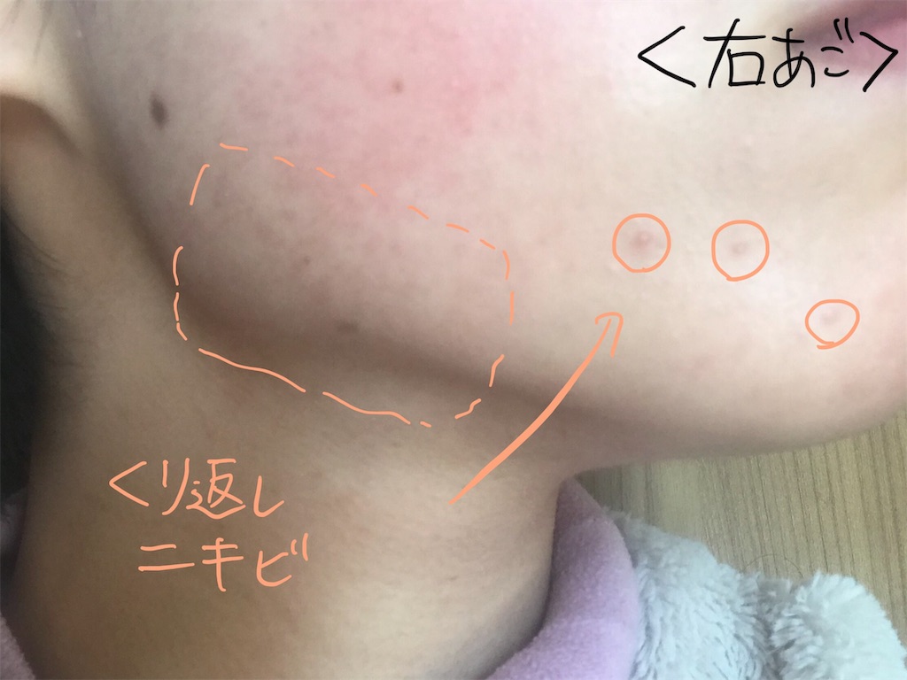 f:id:akkimemo:20190108142124j:image