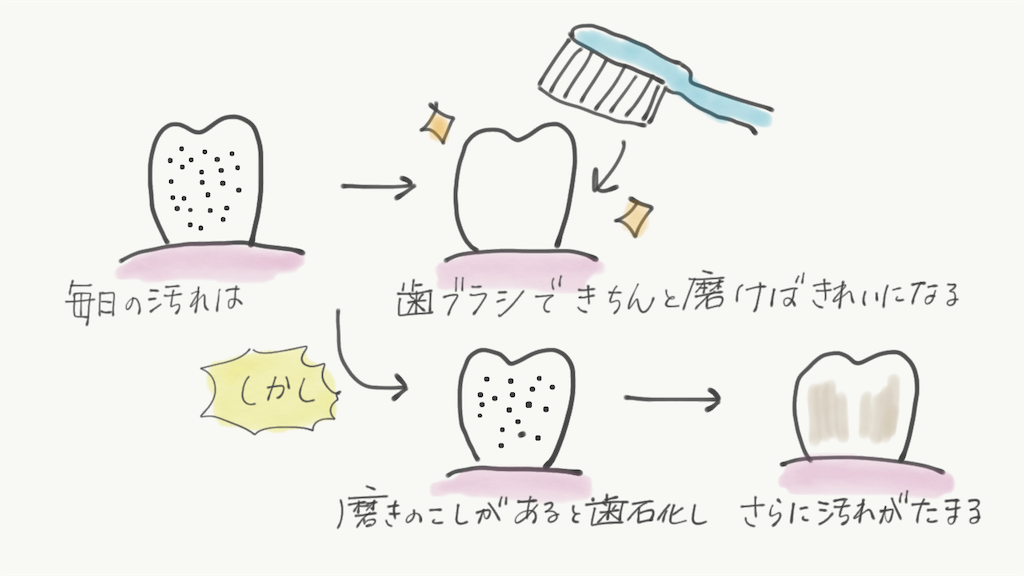 f:id:akkimemo:20190111172121p:image