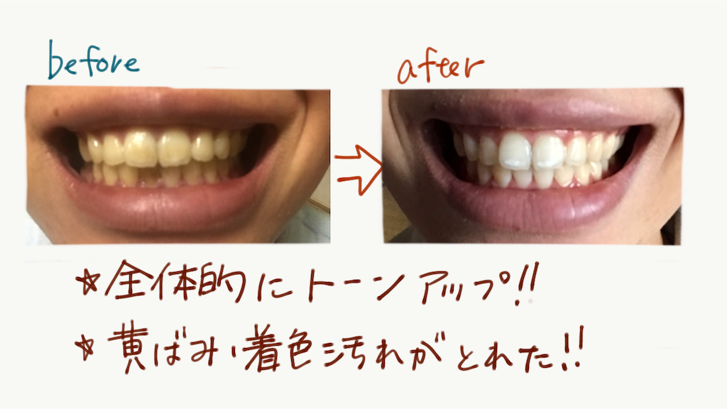 f:id:akkimemo:20190111172222p:image