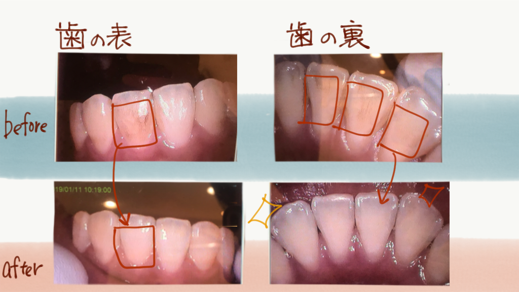 f:id:akkimemo:20190111172350p:image