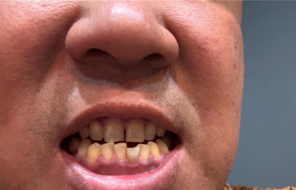 f:id:akoizuminobaka:20250113001520j:image