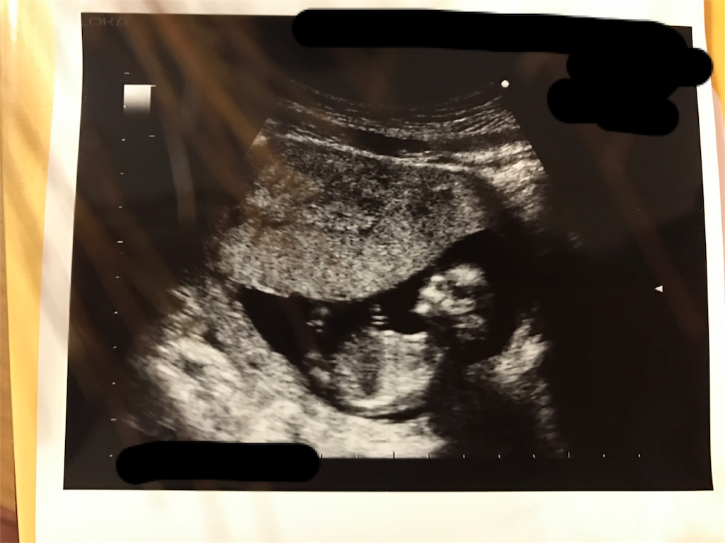 f:id:akokuma:20161228215154p:image