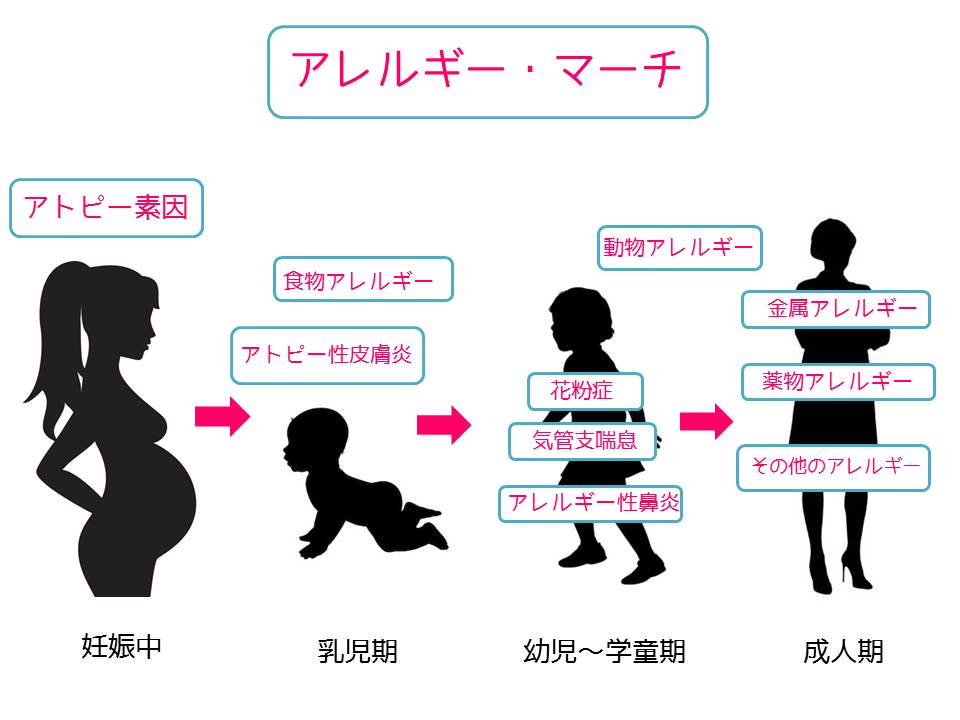 f:id:alba-allergy-clinic:20190907211759j:plain