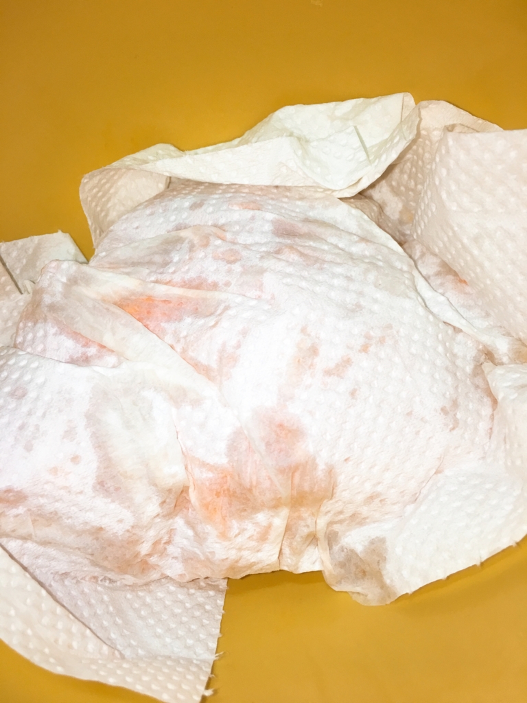 f:id:allergy_nagasakikko:20161109105309j:plain