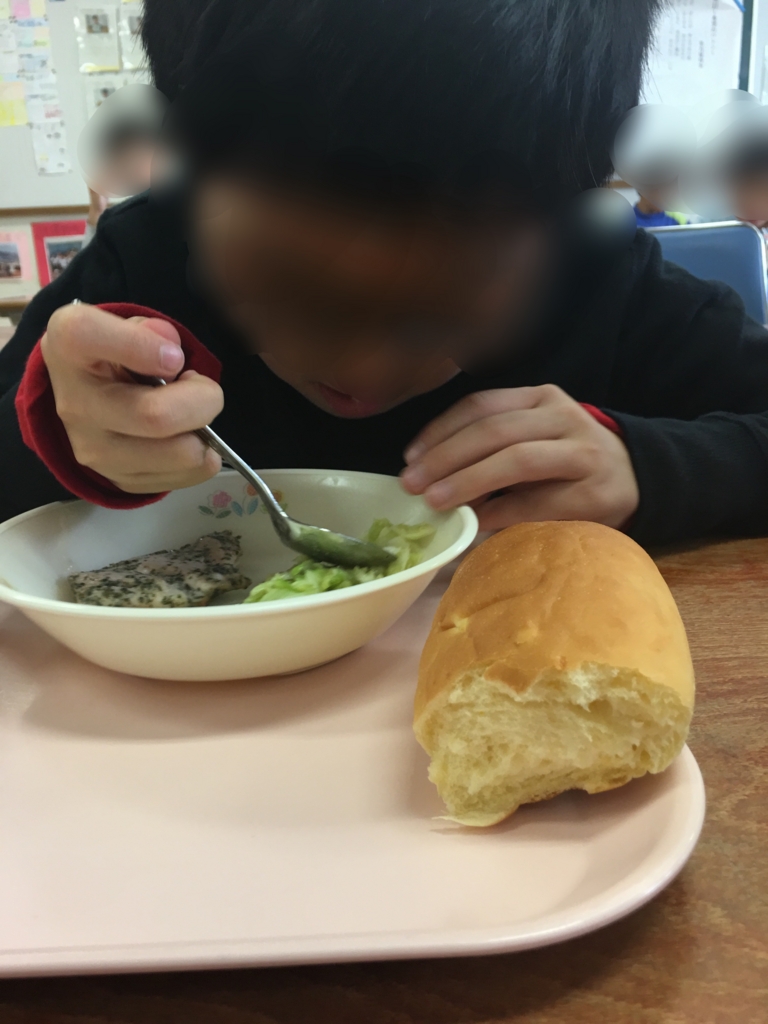 f:id:allergy_nagasakikko:20161111222054j:plain