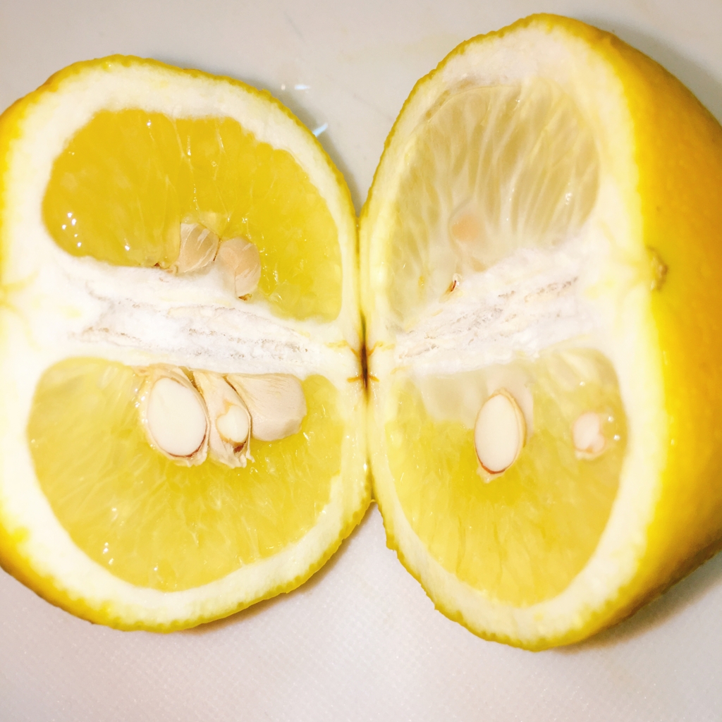 f:id:allergy_nagasakikko:20170217210138j:plain f:id:allergy_nagasakikko:20170217210138j:plain