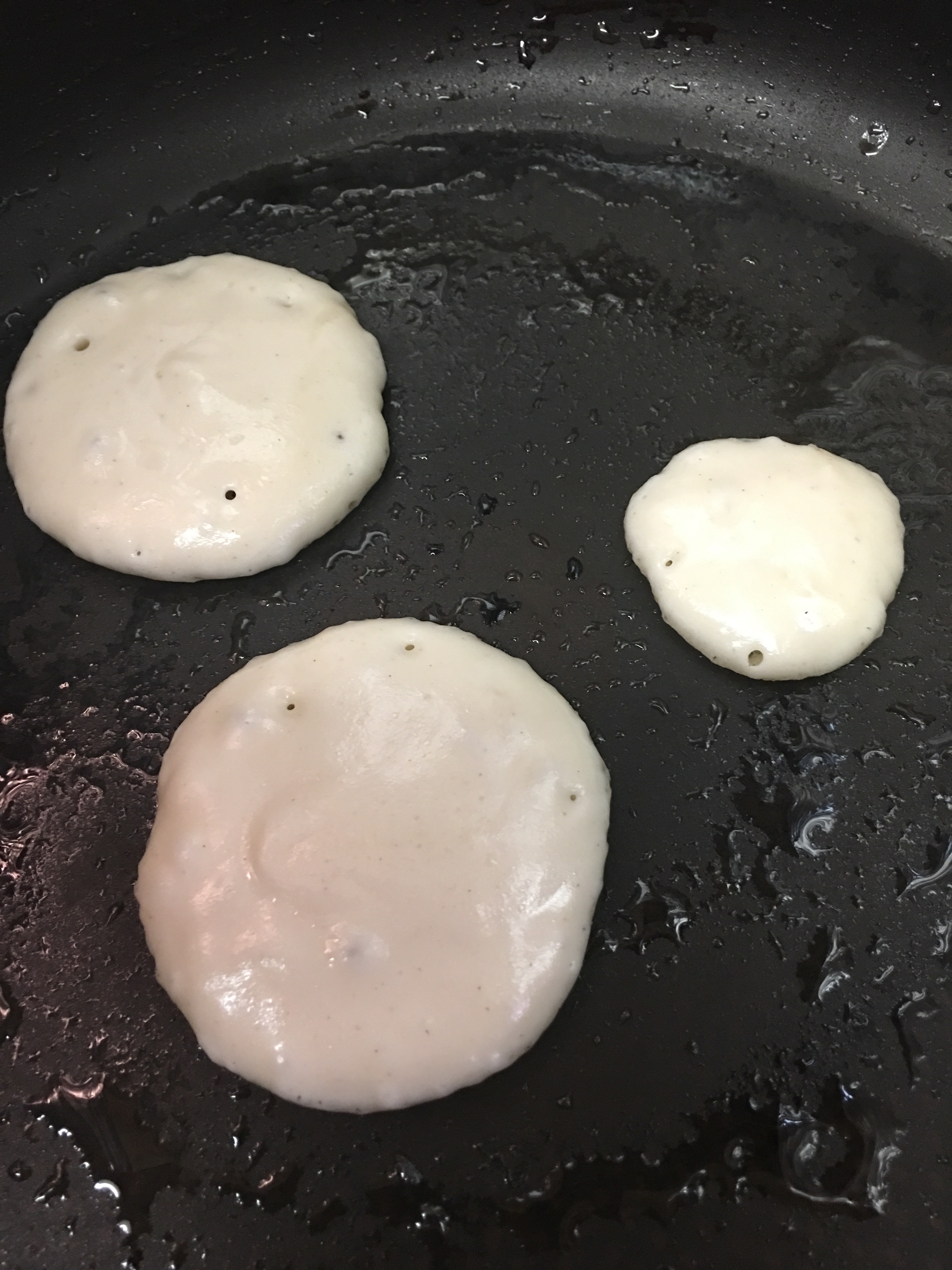 f:id:allergy_nagasakikko:20170315205051j:image f:id:allergy_nagasakikko:20170315205051j:image