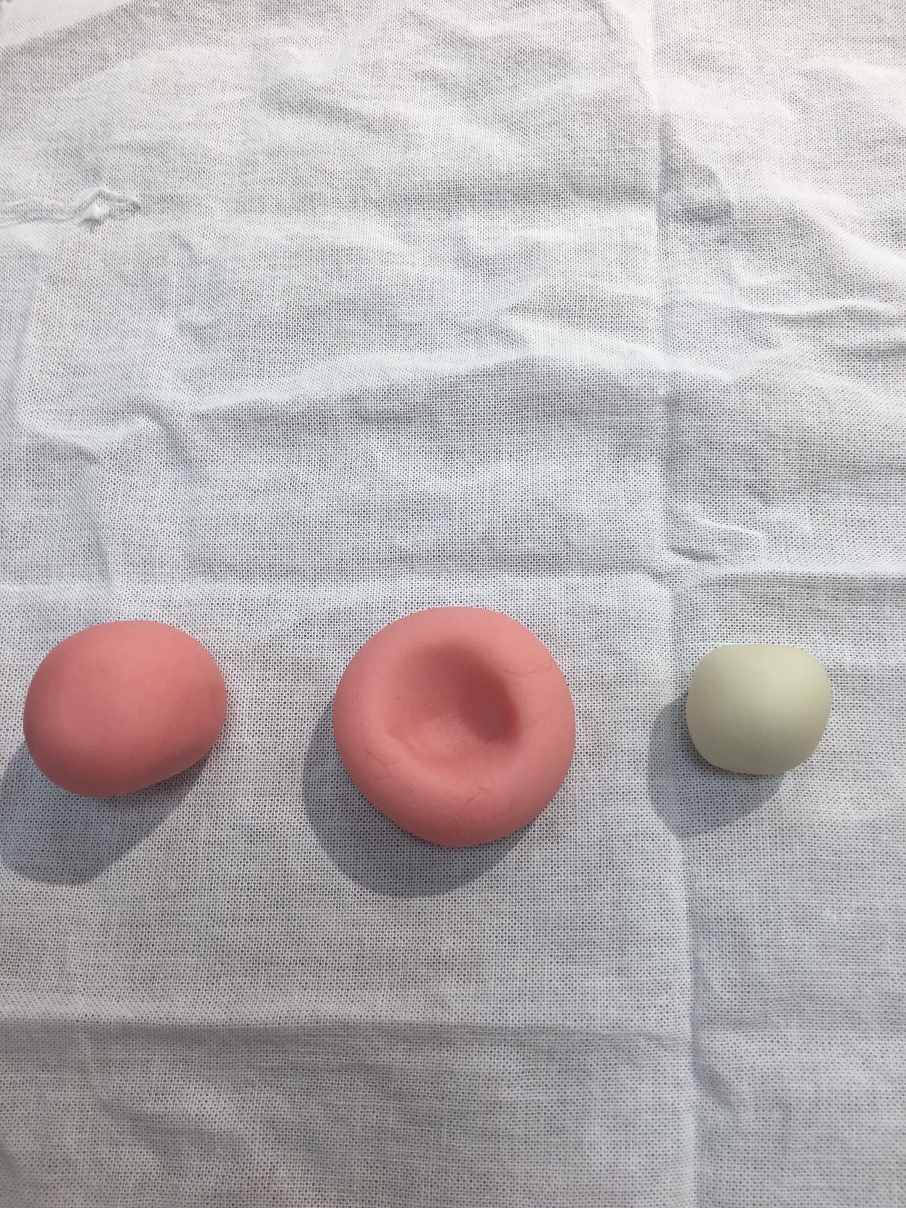 f:id:allergy_nagasakikko:20170316215041j:plain f:id:allergy_nagasakikko:20170316215041j:plain