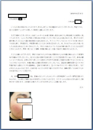 f:id:allergy_nagasakikko:20190909233242j:plain f:id:allergy_nagasakikko:20190909233242j:plain