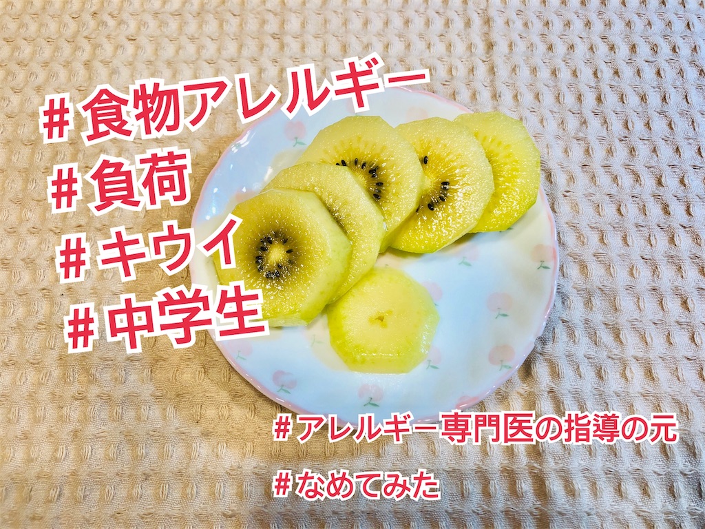 f:id:allergy_nagasakikko:20210606123747j:image f:id:allergy_nagasakikko:20210606123747j:image