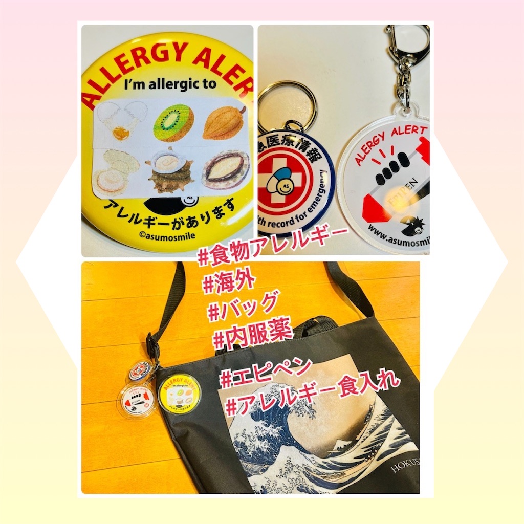 f:id:allergy_nagasakikko:20230603224236j:image f:id:allergy_nagasakikko:20230603224236j:image
