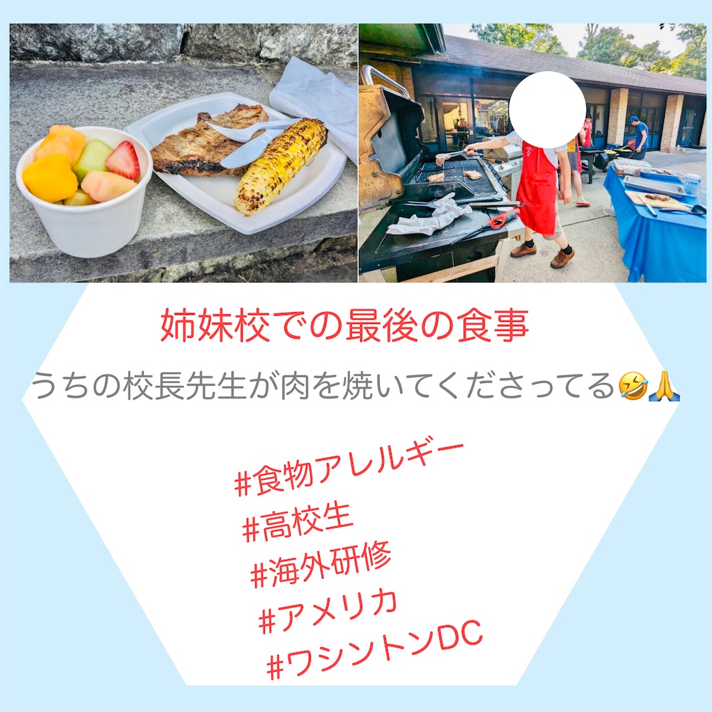 f:id:allergy_nagasakikko:20230708132056j:image f:id:allergy_nagasakikko:20230708132056j:image