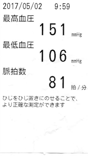 f:id:als20170208:20170502110108j:image