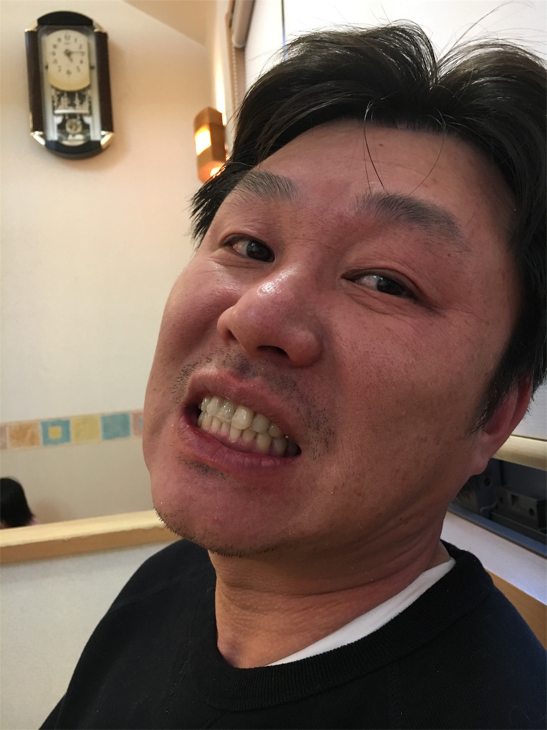 f:id:als20170208:20171114181406j:image