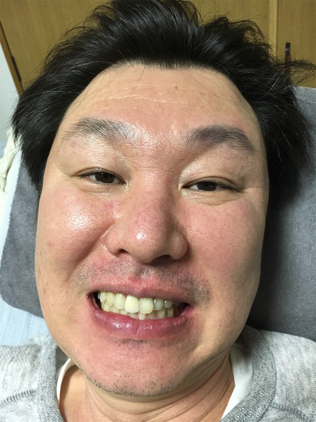 f:id:als20170208:20190609165648j:image