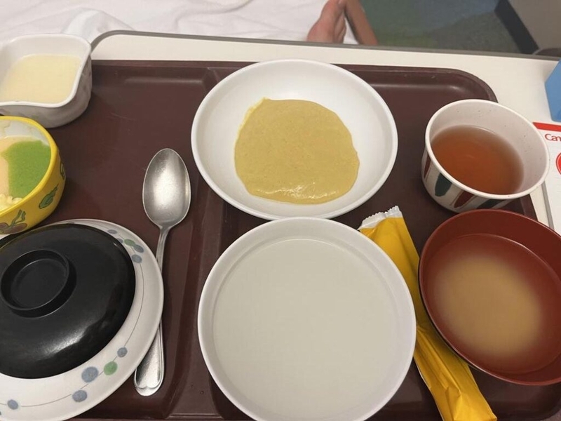 【慢性扁桃炎】将来のキャリアを考え、扁桃腺手術の入院に至ったわけ