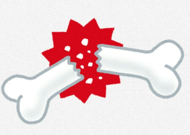 f:id:amgmc:20171006125622j:image